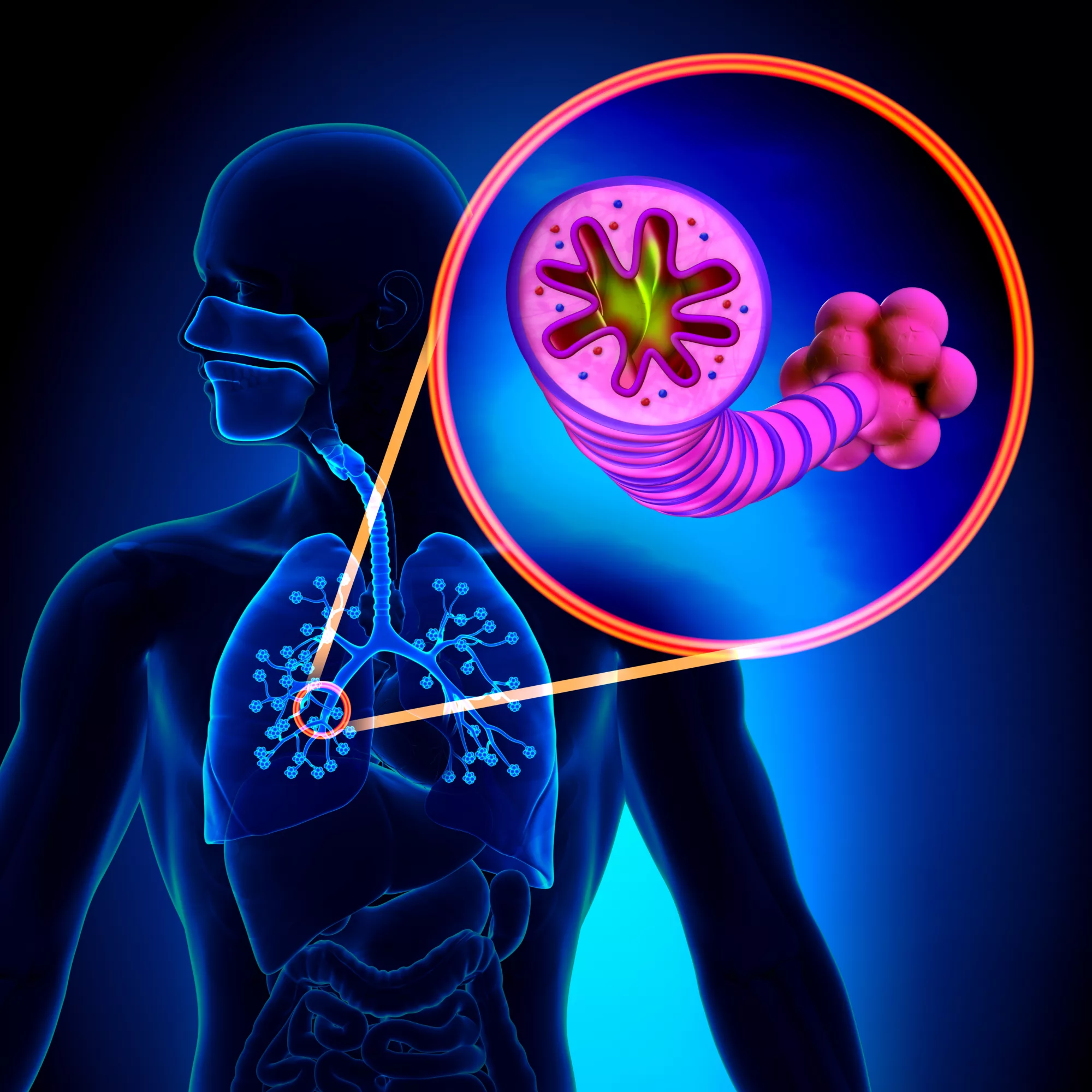 COPD - Chronic obstructive pulmonary disease